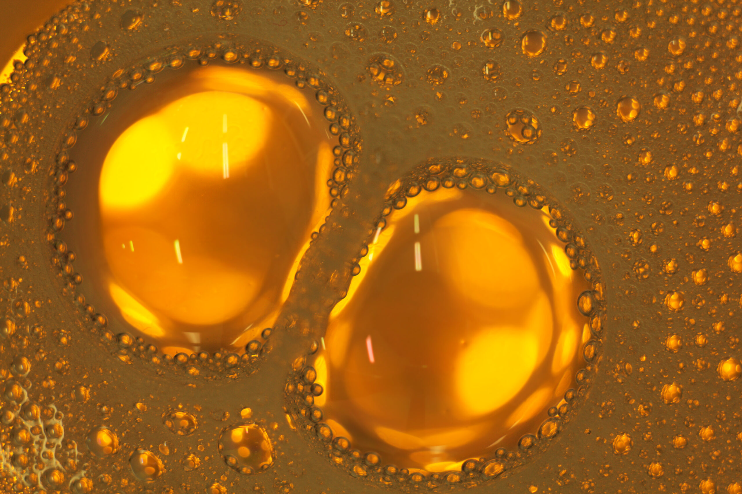 Lipofilling — visuel abstrait de gouttelettes lipidiques, Dr Alexandra Tudosa chirurgien plasticien Saint-Omer