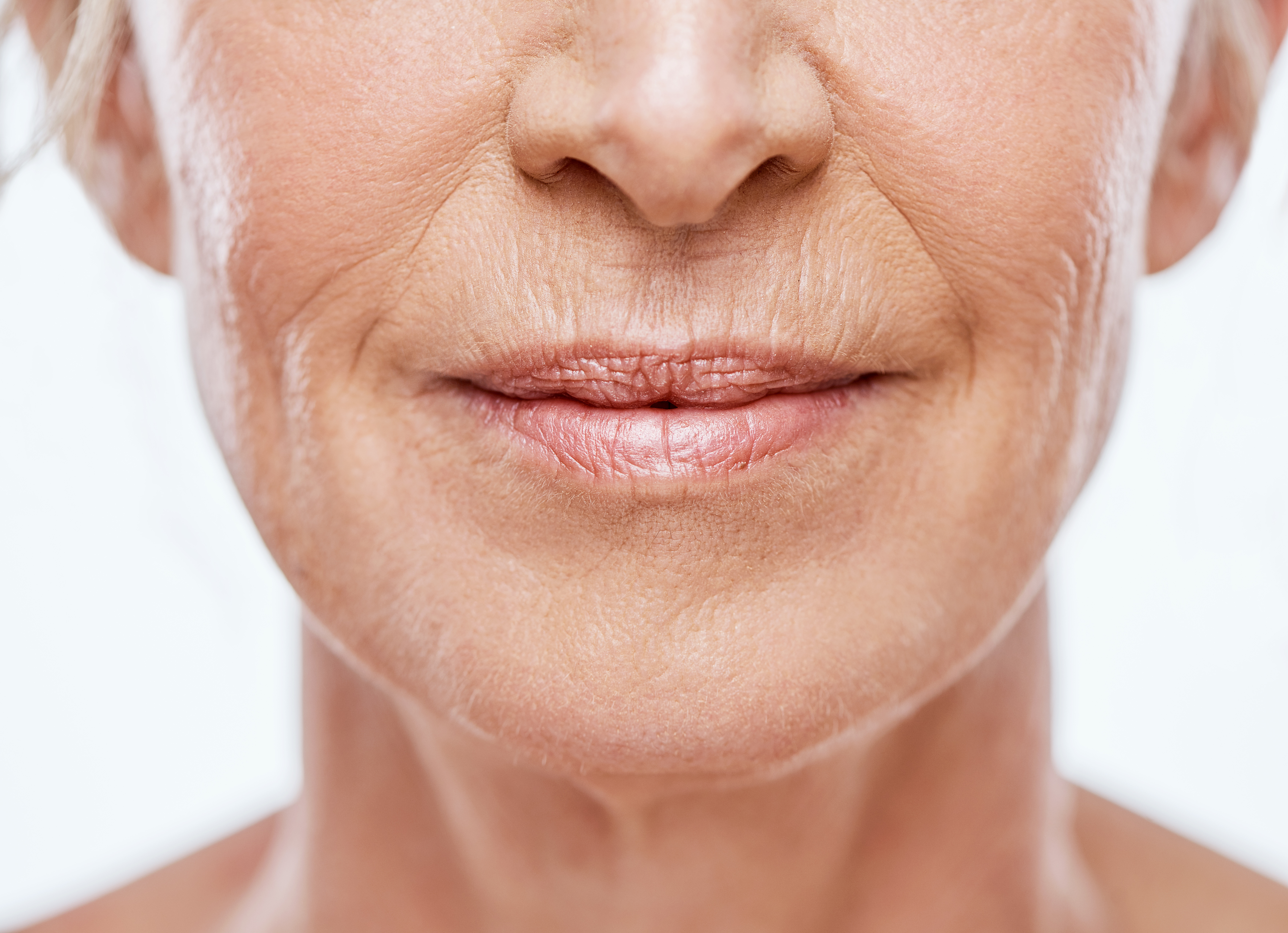 Lip lift — gros plan sur la bouche d'une femme mature, Dr Alexandra Tudosa chirurgien plasticien Saint-Omer